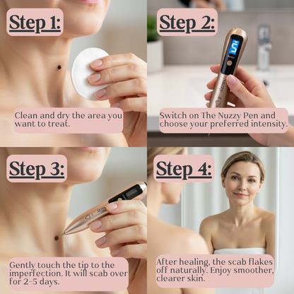 Nuzzy Skin Care Pen – Precision Spot Treatment Device with Replacement Tips